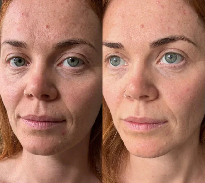 Real customer result