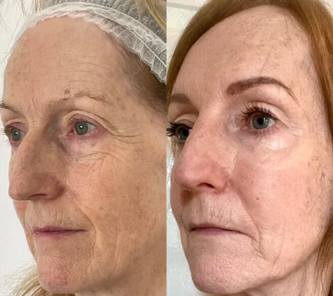 Real customer result