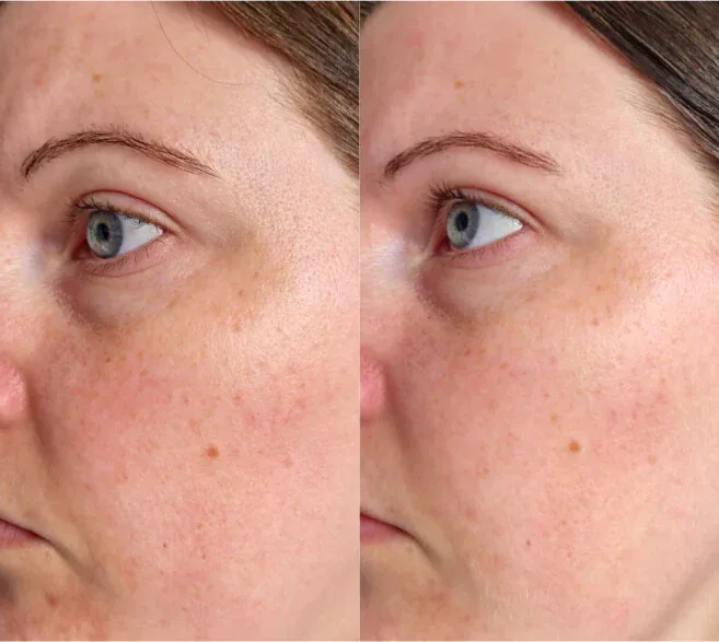 Real customer result